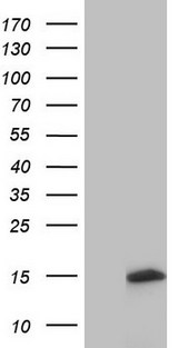 UBA52 Antibody - HEK293T cells were transfected with the pCMV6-ENTRY control. (Left lane) or pCMV6-ENTRY UBA52. (Right lane) cDNA for 48 hrs and lysed. Equivalent amounts of cell lysates. (5 ug per lane) were separated by SDS-PAGE and immunoblotted with anti-UBA52.