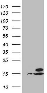 UBA52 Antibody - HEK293T cells were transfected with the pCMV6-ENTRY control. (Left lane) or pCMV6-ENTRY UBA52. (Right lane) cDNA for 48 hrs and lysed. Equivalent amounts of cell lysates. (5 ug per lane) were separated by SDS-PAGE and immunoblotted with anti-UBA52. (1:2000)