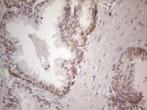 UBA52 Antibody - Immunohistochemical staining of paraffin-embedded Human prostate tissue within the normal limits using anti-UBA52 mouse monoclonal antibody. (Heat-induced epitope retrieval by 1mM EDTA in 10mM Tris buffer. (pH8.5) at 120°C for 3 min. (1:150)
