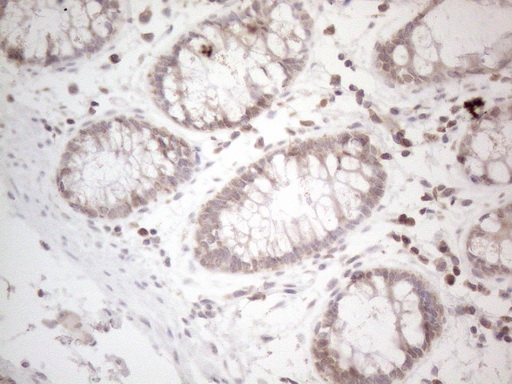 UBA52 Antibody - Immunohistochemical staining of paraffin-embedded Human colon tissue within the normal limits using anti-UBA52 mouse monoclonal antibody. (Heat-induced epitope retrieval by 1mM EDTA in 10mM Tris buffer. (pH8.5) at 120°C for 3 min. (1:150)