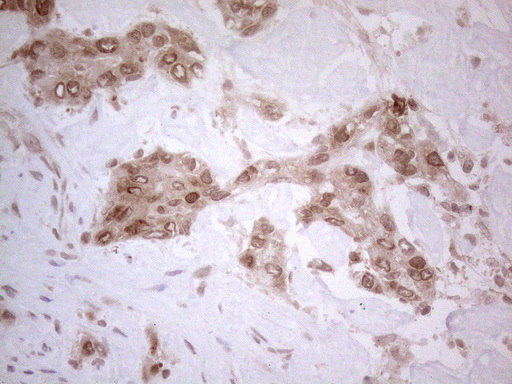 UBA52 Antibody - Immunohistochemical staining of paraffin-embedded Human liver tissue within the normal limits using anti-UBA52 mouse monoclonal antibody. (Heat-induced epitope retrieval by 1mM EDTA in 10mM Tris buffer. (pH8.5) at 120°C for 3 min. (1:150)