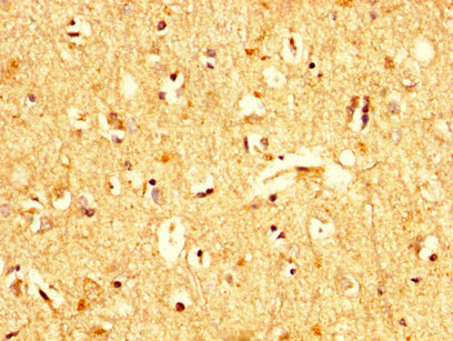 UBA52 Antibody - Immunohistochemistry image at a dilution of 1:200 and staining in paraffin-embedded human brain tissue performed on a Leica BondTM system. After dewaxing and hydration, antigen retrieval was mediated by high pressure in a citrate buffer (pH 6.0) . Section was blocked with 10% normal goat serum 30min at RT. Then primary antibody (1% BSA) was incubated at 4 °C overnight. The primary is detected by a biotinylated secondary antibody and visualized using an HRP conjugated SP system.