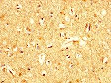 UBA52 Antibody - Immunohistochemistry image at a dilution of 1:200 and staining in paraffin-embedded human brain tissue performed on a Leica BondTM system. After dewaxing and hydration, antigen retrieval was mediated by high pressure in a citrate buffer (pH 6.0) . Section was blocked with 10% normal goat serum 30min at RT. Then primary antibody (1% BSA) was incubated at 4 °C overnight. The primary is detected by a biotinylated secondary antibody and visualized using an HRP conjugated SP system.