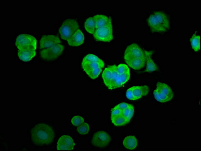 UBA52 Antibody - Immunofluorescence staining of MCF-7 cells with UBA52 Antibody at 1:66, counter-stained with DAPI. The cells were fixed in 4% formaldehyde, permeabilized using 0.2% Triton X-100 and blocked in 10% normal Goat Serum. The cells were then incubated with the antibody overnight at 4°C. The secondary antibody was Alexa Fluor 488-congugated AffiniPure Goat Anti-Rabbit IgG(H+L).