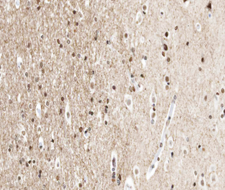 UBA52 Antibody - 1:100 staining human brain tissue by IHC-P. The tissue was formaldehyde fixed and a heat mediated antigen retrieval step in citrate buffer was performed. The tissue was then blocked and incubated with the antibody for 1.5 hours at 22°C. An HRP conjugated goat anti-rabbit antibody was used as the secondary.