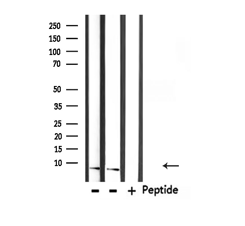 UBA52 Antibody - Western blot analysis of extracts of 293 cells and mouse lung using Ubiquitin antibody.