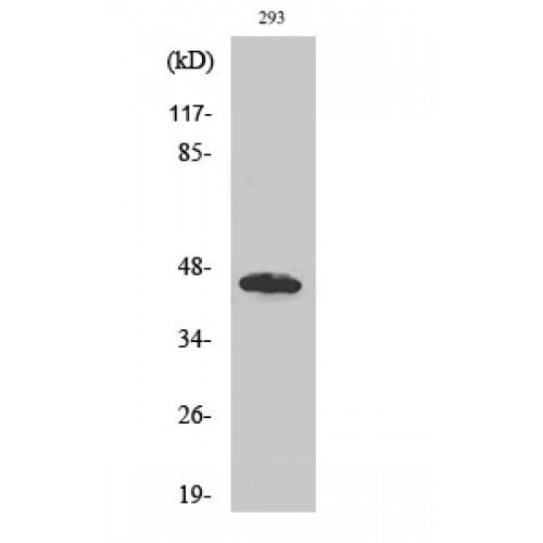 UBAC1 / KPC2 Antibody - Western blot of GBDR1 antibody