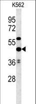 UBAC1 / KPC2 Antibody - UBAC1 Antibody western blot of K562 cell line lysates (35 ug/lane). The UBAC1 antibody detected the UBAC1 protein (arrow).