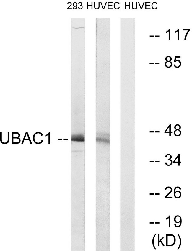 UBAC1 / KPC2 Antibody - Western blot analysis of lysates from 293 and HUVEC cells, using UBAC1 Antibody. The lane on the right is blocked with the synthesized peptide.