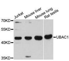 UBAC1 / KPC2 Antibody - Western blot analysis of extracts of various cell lines, using UBAC1 antibody at 1:3000 dilution. The secondary antibody used was an HRP Goat Anti-Rabbit IgG (H+L) at 1:10000 dilution. Lysates were loaded 25ug per lane and 3% nonfat dry milk in TBST was used for blocking. An ECL Kit was used for detection and the exposure time was 30s.