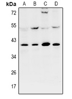 UBAC1 / KPC2 Antibody - Western blot analysis of KPC2 expression in MCF7 (A), HCT116 (B), PC12 (C), AML12 (D) whole cell lysates.