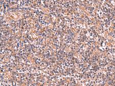 UBAC1 / KPC2 Antibody - Immunohistochemistry of paraffin-embedded Human tonsil tissue  using UBAC1 Polyclonal Antibody at dilution of 1:50(×200)