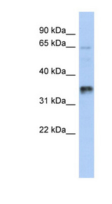 UBAC2 Antibody - UBAC2 antibody Western blot of 721_B cell lysate. This image was taken for the unconjugated form of this product. Other forms have not been tested.