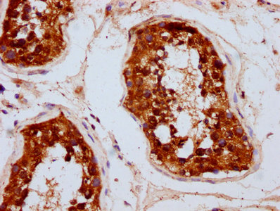 UBAC2 Antibody - Immunohistochemistry Dilution at 1:300 and staining in paraffin-embedded human testis tissue performed on a Leica BondTM system. After dewaxing and hydration, antigen retrieval was mediated by high pressure in a citrate buffer (pH 6.0). Section was blocked with 10% normal Goat serum 30min at RT. Then primary antibody (1% BSA) was incubated at 4°C overnight. The primary is detected by a biotinylated Secondary antibody and visualized using an HRP conjugated SP system.