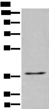 UBAC2 Antibody - Western blot analysis of 231 cell lysate  using UBAC2 Polyclonal Antibody at dilution of 1:400
