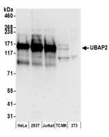UBAP2 Antibody - Detection of human and mouse UBAP2 by western blot. Samples: Whole cell lysate (50 µg) from HeLa, HEK293T, Jurkat, mouse TCMK-1, and mouse NIH 3T3 cells prepared using NETN lysis buffer. Antibodies: Affinity purified rabbit anti-UBAP2 antibody used for WB at 0.1 µg/ml. Detection: Chemiluminescence with an exposure time of 30 seconds.