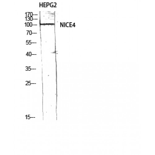 UBAP2L Antibody - Western blot of NICE4 antibody