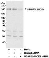 UBAP2L Antibody - Detection of Human UBAP2L/NICE4 by Western Blot. Samples: Whole cell lysate (40 ug) from HeLa cells either mock treated, treated with a control siRNA, or treated with siRNA for UBAP2L/NICE4. Antibody: Affinity purified rabbit anti-UBAP2L/NICE4 antibody used at 0.03 ug/ml. Detection: Chemiluminescence with an exposure time of 30 seconds.