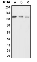 UBAP2L Antibody - Western blot analysis of NICE4 expression in MCF7 (A); SP2/0 (B); H9C2 (C) whole cell lysates.