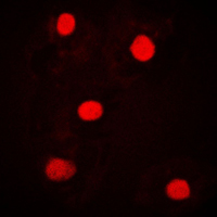 UBAP2L Antibody - Immunofluorescent analysis of NICE4 staining in MCF7 cells. Formalin-fixed cells were permeabilized with 0.1% Triton X-100 in TBS for 5-10 minutes and blocked with 3% BSA-PBS for 30 minutes at room temperature. Cells were probed with the primary antibody in 3% BSA-PBS and incubated overnight at 4 C in a humidified chamber. Cells were washed with PBST and incubated with a DyLight 594-conjugated secondary antibody (red) in PBS at room temperature in the dark. DAPI was used to stain the cell nuclei (blue).