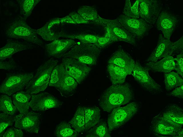 UBAP2L Antibody - Immunofluorescence staining of UBAP2L in U2OS cells. Cells were fixed with 4% PFA, permeabilzed with 0.1% Triton X-100 in PBS, blocked with 10% serum, and incubated with rabbit anti-Human UBAP2L polyclonal antibody (dilution ratio 1:200) at 4°C overnight. Then cells were stained with the Alexa Fluor 488-conjugated Goat Anti-rabbit IgG secondary antibody (green). Positive staining was localized to Nucleus and Cytoplasm.