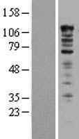 UBAP2L Protein - Western validation with an anti-DDK antibody * L: Control HEK293 lysate R: Over-expression lysate