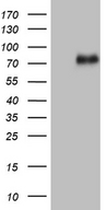 UBASH3A / CLIP4 Antibody - HEK293T cells were transfected with the pCMV6-ENTRY control. (Left lane) or pCMV6-ENTRY UBASH3A. (Right lane) cDNA for 48 hrs and lysed. Equivalent amounts of cell lysates. (5 ug per lane) were separated by SDS-PAGE and immunoblotted with anti-UBASH3A. (1:2000)
