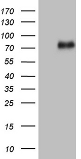 UBASH3A / CLIP4 Antibody - HEK293T cells were transfected with the pCMV6-ENTRY control. (Left lane) or pCMV6-ENTRY UBASH3A. (Right lane) cDNA for 48 hrs and lysed