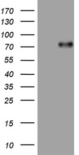 UBASH3A / CLIP4 Antibody - HEK293T cells were transfected with the pCMV6-ENTRY control. (Left lane) or pCMV6-ENTRY UBASH3A. (Right lane) cDNA for 48 hrs and lysed. Equivalent amounts of cell lysates. (5 ug per lane) were separated by SDS-PAGE and immunoblotted with anti-UBASH3A. (1:500)