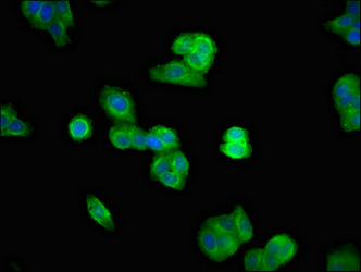 UBASH3A / CLIP4 Antibody - Immunofluorescent analysis of HepG2 cells at a dilution of 1:100 and Alexa Fluor 488-congugated AffiniPure Goat Anti-Rabbit IgG(H+L)