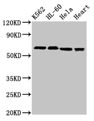 UBASH3A / CLIP4 Antibody - Western Blot Positive WB detected in: K562 whole cell lysate, HL60 whole cell lysate, Hela whole cell lysate, Rat heart tissue All lanes: UBASH3A antibody at 3µg/ml Secondary Goat polyclonal to rabbit IgG at 1/50000 dilution Predicted band size: 75, 70, 60 kDa Observed band size: 70 kDa