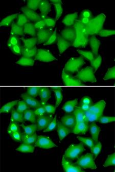 UBASH3B / STS-1 Antibody - Immunofluorescence analysis of A549 cells.
