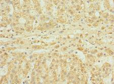 UBASH3B / STS-1 Antibody - Immunohistochemistry of paraffin-embedded human adrenal gland tissue at dilution 1:100