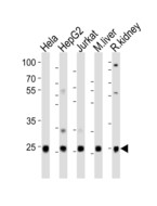 UBB / Ubiquitin B Antibody - Western blot of lysates from HeLa, HepG2, Jurkat cell line, mouse liver, rat kidney tissue (from left to right) with UBB (Ubiquitin) Antibody. Antibody was diluted at 1:1000 at each lane. A goat anti-rabbit IgG H&L (HRP) at 1:10000 dilution was used as the secondary antibody. Lysates at 20 ug per lane.