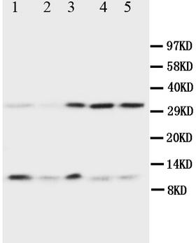 UBB / Ubiquitin B Antibody - WB of UBB / Ubiquitin B antibody. Lane 1: Rat Thymus Tissue Lysate. Lane 2: MCF-7 Cell Lysate. Lane 3: MM231 Cell Lysate. Lane 4: HELA Cell Lysate. Lane 5: SMMC Cell Lysate.