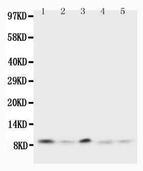 UBB / Ubiquitin B Antibody - Anti-Ubiquitin antibody, Western blotting Lane 1: Rat Thymus Tissue LysateLane 2: Human MCF-7 Cell LysateLane 3: MM231 Cell LysateLane 4: HELA Cell LysateLane 5: SMMC Cell Lysate