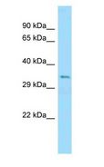 UBB / Ubiquitin B Antibody - UBB / Ubiquitin B antibody Western Blot of Mouse Pancreas.  This image was taken for the unconjugated form of this product. Other forms have not been tested.