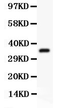 UBB / Ubiquitin B Antibody - Ubiquitin antibody Western blot. All lanes: Anti Ubiquitin at 0.5 ug/ml. WB: Recombinant Human Ubiquitin Protein 0.5ng. Predicted band size: 36 kD. Observed band size: 36 kD.