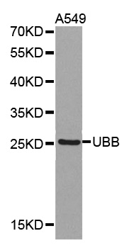 UBB / Ubiquitin B Antibody - Western blot analysis of extracts of A549 cell lines.