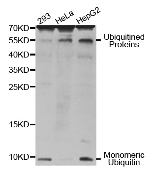 UBB / Ubiquitin B Antibody - Western blot analysis of extracts of various cell lines, using UBB antibody. The secondary antibody used was an HRP Goat Anti-Rabbit IgG (H+L) at 1:10000 dilution. Lysates were loaded 25ug per lane and 3% nonfat dry milk in TBST was used for blocking.