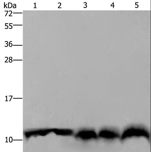 UBB / Ubiquitin B Antibody - Western blot analysis of Mouse pancreas tissue, HeLa cell and mouse liver tissue, A549 and 293T cell, using UBB Polyclonal Antibody at dilution of 1:500.
