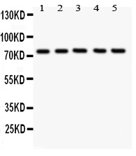 UBB / Ubiquitin B Antibody - anti-12 Lipoxygenase antibody, Western blotting All lanes: Anti ANOX12 at 0.5ug/ml Lane 1: A549 Whole Cell Lysate at 40ug Lane 2: MCF-7 Whole Cell Lysate at 40ug Lane 3: COLO320 Whole Cell Lysate at 40ug Lane 4: JURKAT Whole Cell Lysate at 40ug Lane 5: HELA Whole Cell Lysate at 40ug Predicted bind size: 75KD Observed bind size: 75KD