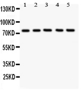 UBB / Ubiquitin B Antibody - anti-12 Lipoxygenase antibody, Western blotting All lanes: Anti ANOX12 at 0.5ug/ml Lane 1: A549 Whole Cell Lysate at 40ug Lane 2: MCF-7 Whole Cell Lysate at 40ug Lane 3: COLO320 Whole Cell Lysate at 40ug Lane 4: JURKAT Whole Cell Lysate at 40ug Lane 5: HELA Whole Cell Lysate at 40ug Predicted bind size: 75KD Observed bind size: 75KD