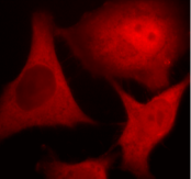 UBC / Ubiquitin C Antibody - 2% formaldehyde-fixed HeLa cells, 100X magnification