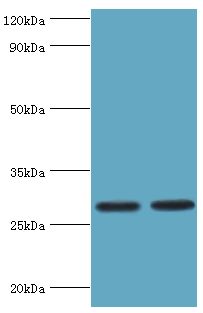 UBC6 / UBE2J2 Antibody - Western blot. All lanes: Ubiquitin-conjugating enzyme E2 J2 antibody at 5 ug/ml. Lane 1: HepG2 whole cell lysate. Lane 2: rat small intestine tissue. Secondary antibody: Goat polyclonal to rabbit at 1:10000 dilution. Predicted band size: 29 kDa. Observed band size: 29 kDa.