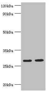 UBC6 / UBE2J2 Antibody - Western blot All lanes: Ubiquitin-conjugating enzyme E2 J2 antibody at 5µg/ml Lane 1: HepG2 whole cell lysate Lane 2: Rat small intestine tissue Secondary Goat polyclonal to rabbit IgG at 1/10000 dilution Predicted band size: 29, 25, 31 kDa Observed band size: 29 kDa