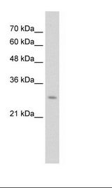 UBC6 / UBE2J2 Antibody - HepG2 Cell Lysate.  This image was taken for the unconjugated form of this product. Other forms have not been tested.