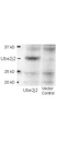 UBC6 / UBE2J2 Antibody - Anti-Ube2j2 Antibody - Western Blot. Western blot of affinity purified anti-Ube2j2 antibody shows detection of Ube2j2 in 293 cells over-expressing Myc-Ube2j2 (Lane 1). Lane 2 contains lysate from mock-transfected 293 cells. Personal Communication, A. Weissman & T. Shang, CCR-NCI, Frederick, MD.