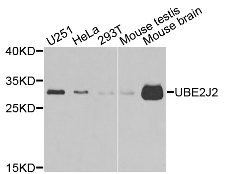 UBC6 / UBE2J2 Antibody - Western blot analysis of extracts of various cells.