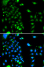 UBC6 / UBE2J2 Antibody - Immunohistochemistry of paraffin-embedded rat liver tissue.